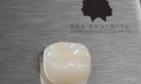 Керамические коронки Cerec