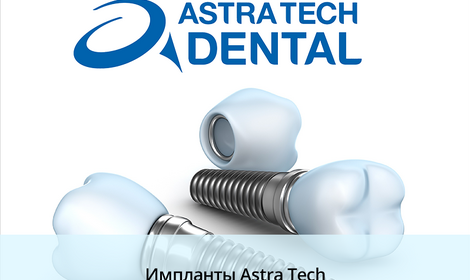 Импланты Astra Tech