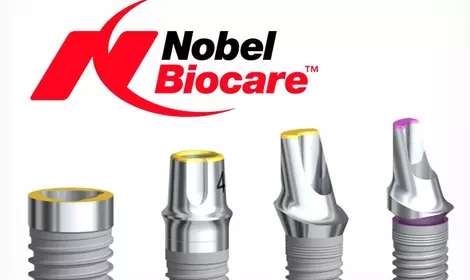 Особенности имплантатов Nobel Biocare