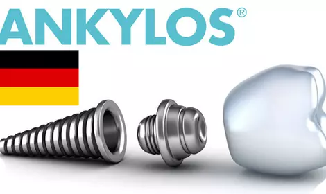 Имплантаты Ankylos