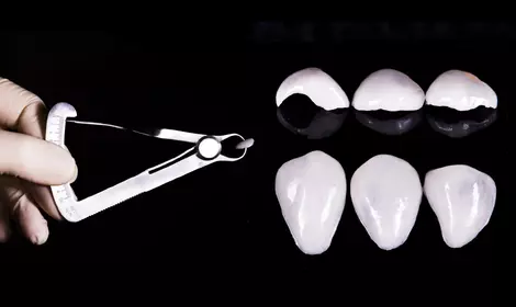 Виниры Cerec