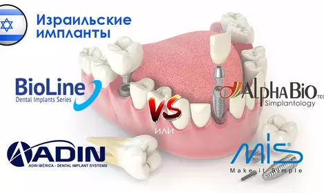 Израильские импланты зубов