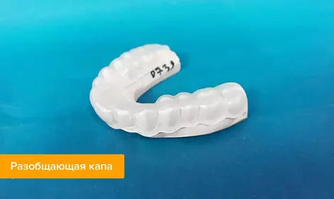 Разобщающая каппа