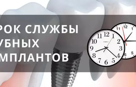 Срок службы имплантов