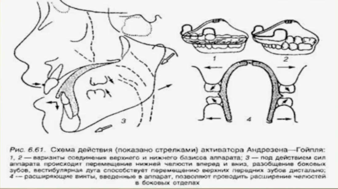 схема действия аппарата Андрезена-Гойпля